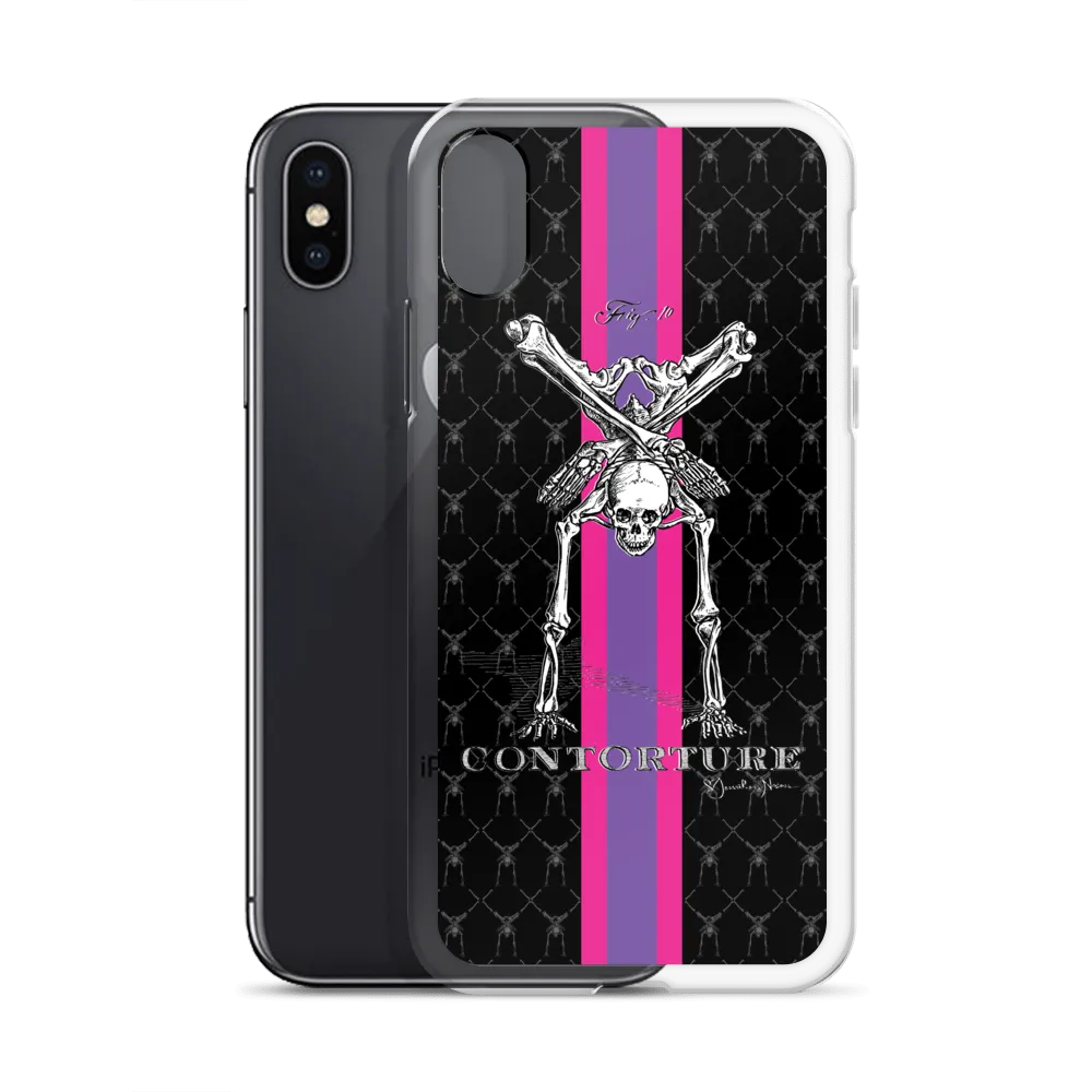 Contorture iPhone Case: SuperStripe Contortion Skeleton